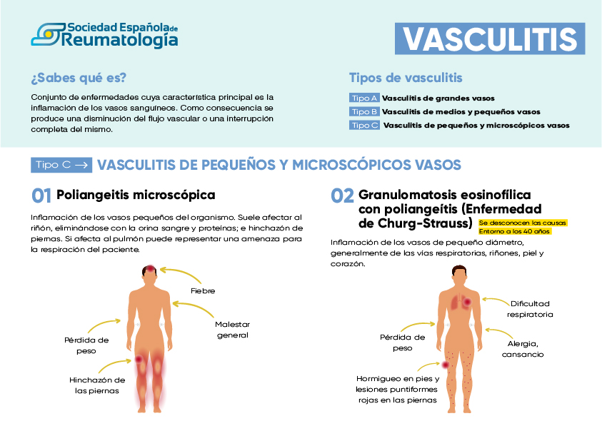 de vasculitis - Inforeuma