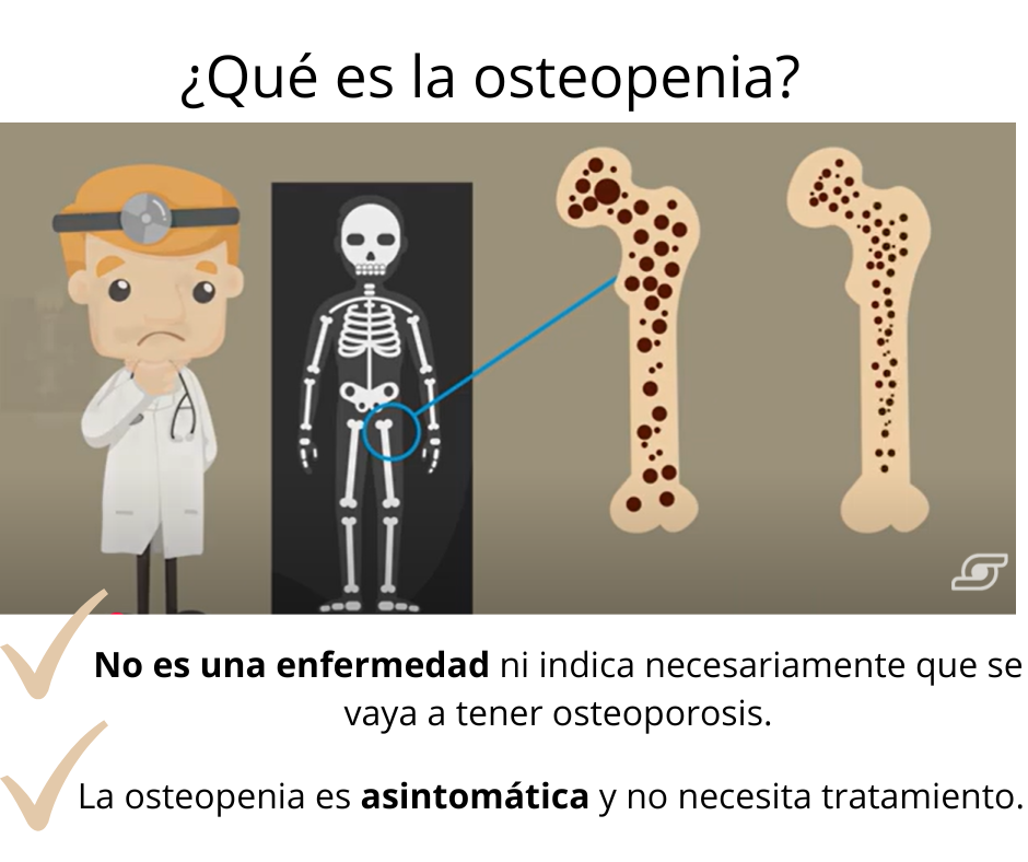 Qué es la osteopenia