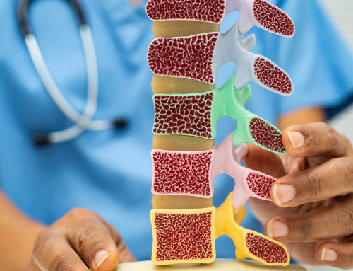 La osteoporosis, una enfermedad silente