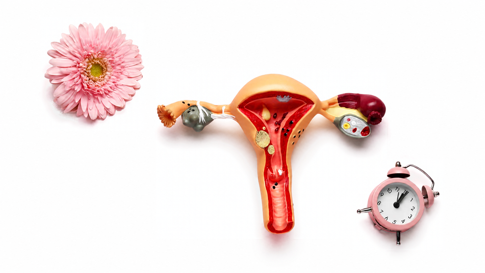 Menopausia