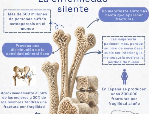 La prevención de la osteoporosis debe empezar en la infancia